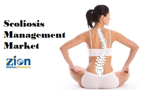 Scoliosis Management Market: Global Industry Analysis, Size, Share, Growth, Trends, and Forecasts 2016–2024