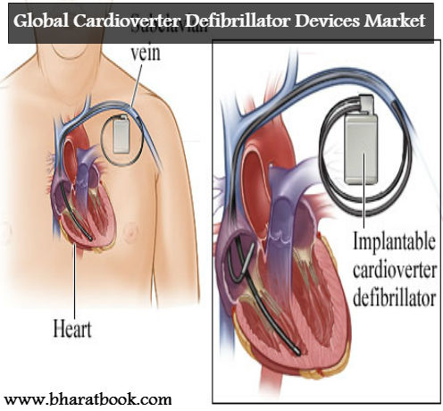 Global Cardioverter Defibrillator Devices Market : Industry Trends, Share, Size, Growth, Opportunity and Forecast 2022