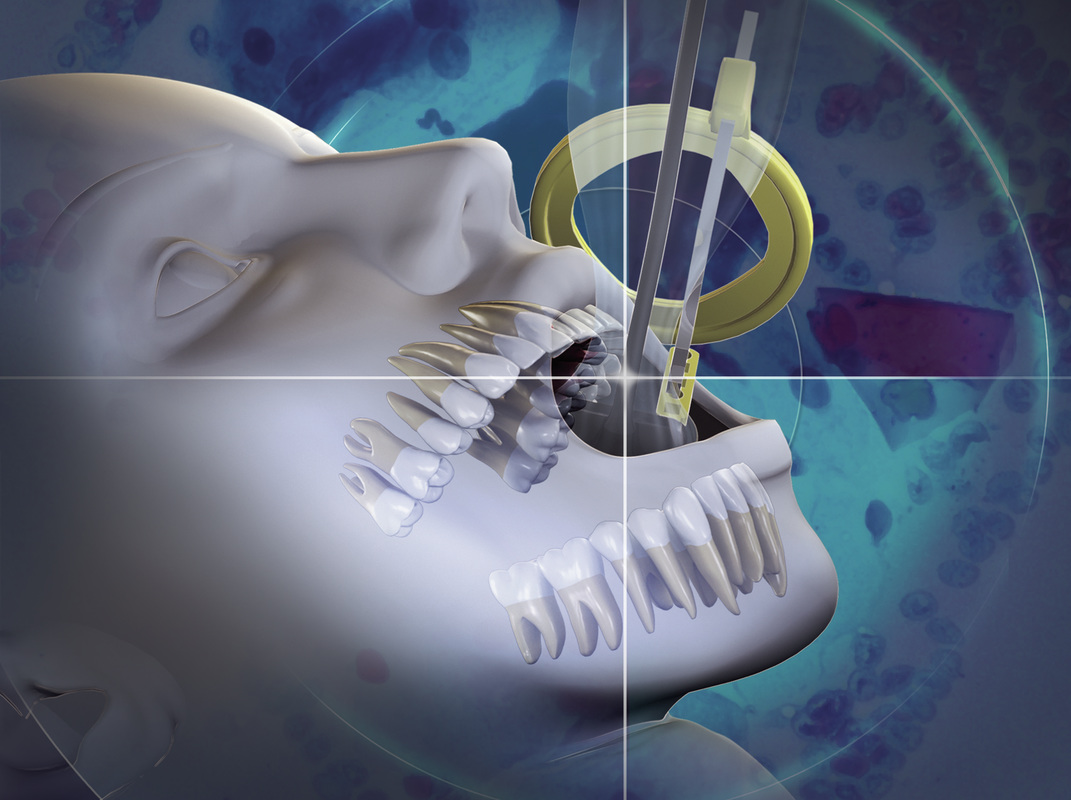 Impact of Global Dental Radiography Systems Market on 2025 industry