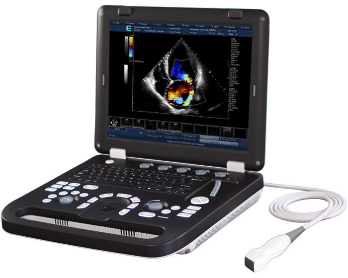 Global Cardiovascular Ultrasound Imaging Systems Market Research Report 2017-2022 by Players, Regions, Product Types & Applications - Biocare (China) CHISON Medical Imaging (China) Esaote (Italy)
