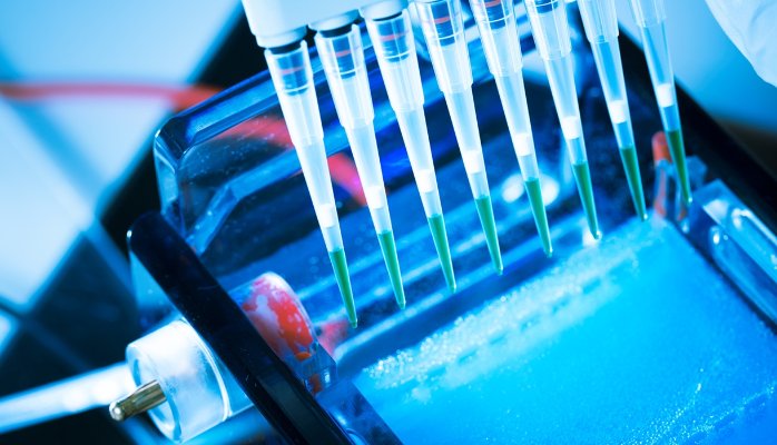 Global and Regional In Vitro Diagnostics / IVD Industry Outlook 2018 Growth, Trends, Forecasts 2023
