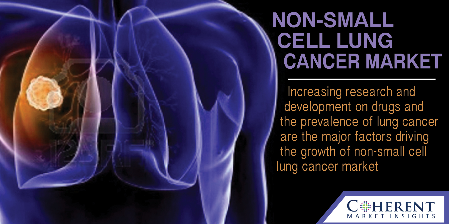 Non-Small Cell Lung Cancer Market - Industry Trend, Market Size, Statistics, Share, Overview till 2024