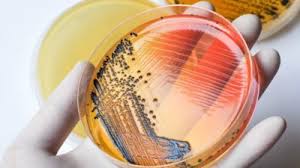 Enteric Disease Testing Market 2018 Size, Share, Growth, Trend, Industry Analysis and 2025 Forecast Research | Top Players are Alere, Becton Dickinson, Bio Rad Laboratories, Biomerica, Cepheid