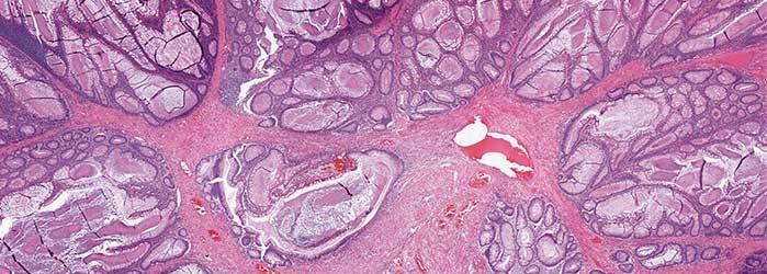 Digital Pathology Market: Global Analysis And Opportunity Assessment 2018-2023