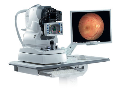 Fundus Cameras Market Report | Top Key Players are - Canon, Inc., Carl Zeiss Meditec, Inc., CenterVue SpA, Clarity Medical Systems, Inc., Kowa Company Ltd.