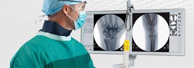 Surgical Imaging Market Segmentation and CAGR of 5.3% from 2018 to 2025