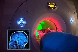 MRI Contrast Agents Market 2019- Global Industry Size, Share, Top Manufacturers, Cost Structure, Growth Analysis, and Forecast to 2025