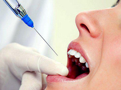 Dental Drug Market 2019 Global Leading Players, Industry Updates, Future Growth, Forthcoming Developments and Future Investments by Forecast
