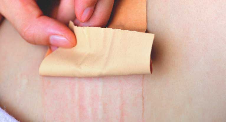Transdermal Patch Market 2024: Top Companies, Regional Growth Overview and Growth Factors Details by Regions, Types and Applications