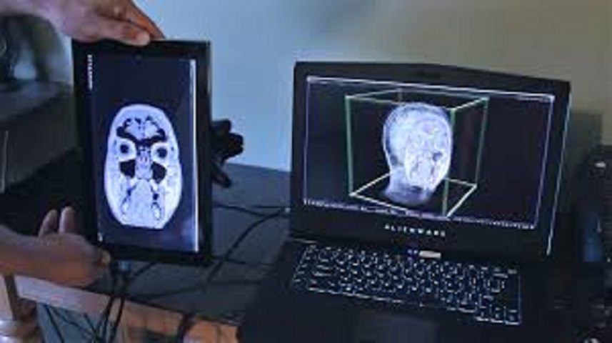 3D Imaging In Tablet Industry: Global Market Trend, Share, Profit, Growth and Key Manufacturers Analysis Report
