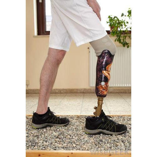 Above Knee Prosthetics Market Development and Industry Dynamics, Competitive Share & Forecast Report: QY Research, Inc