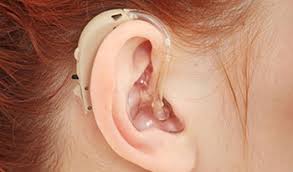 Hearing Aids Market Analysis and Forecast Report (2019 - 2025)| QY Research