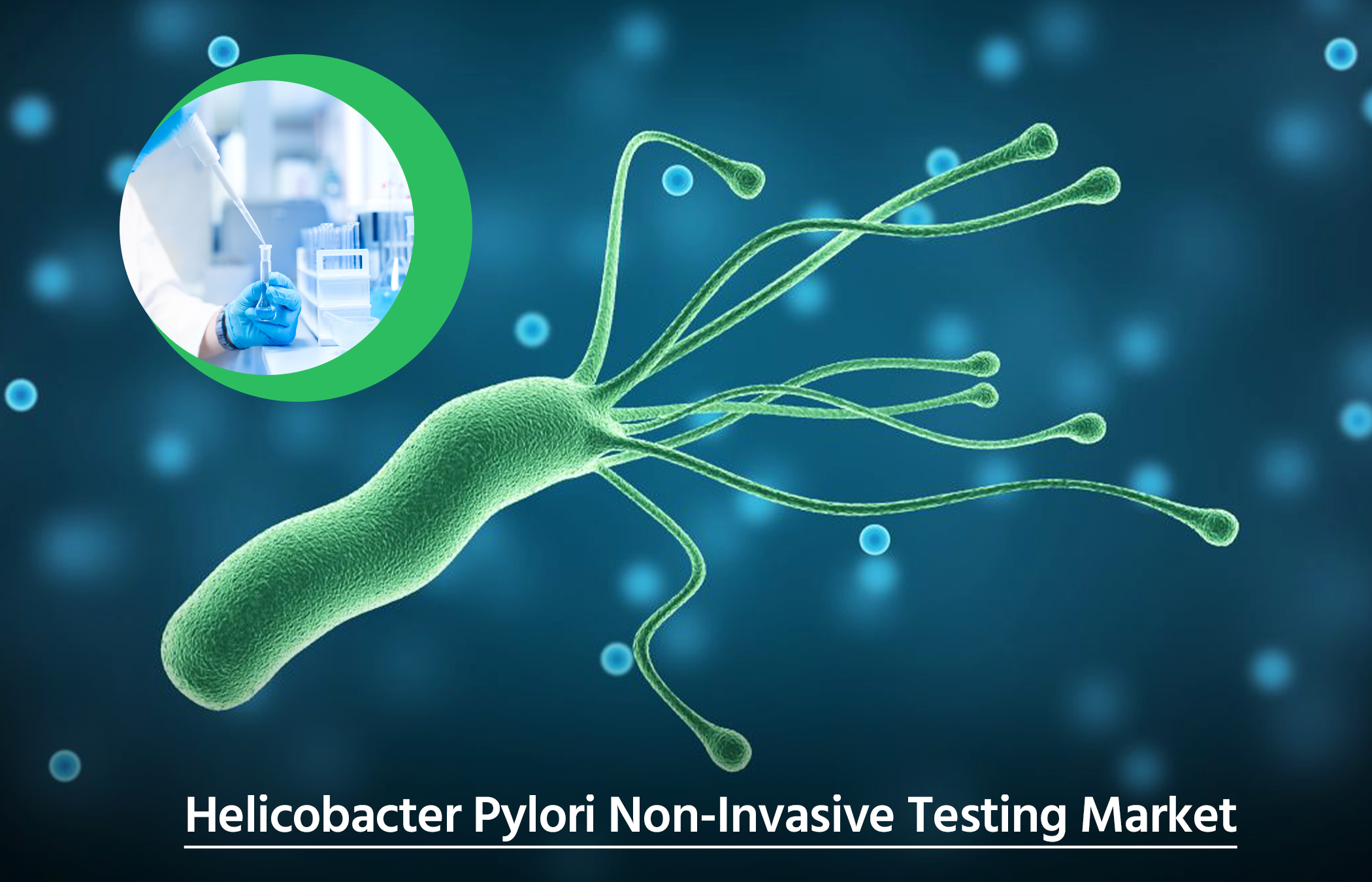 Helicobacter Pylori Non-invasive Testing Market Analysis by Top Players (2019-2030) | Meridian Bioscience, DiaSorin S.p.A, Sekisui Diagnostics, Biomerica, CorisBioconcept SPRL