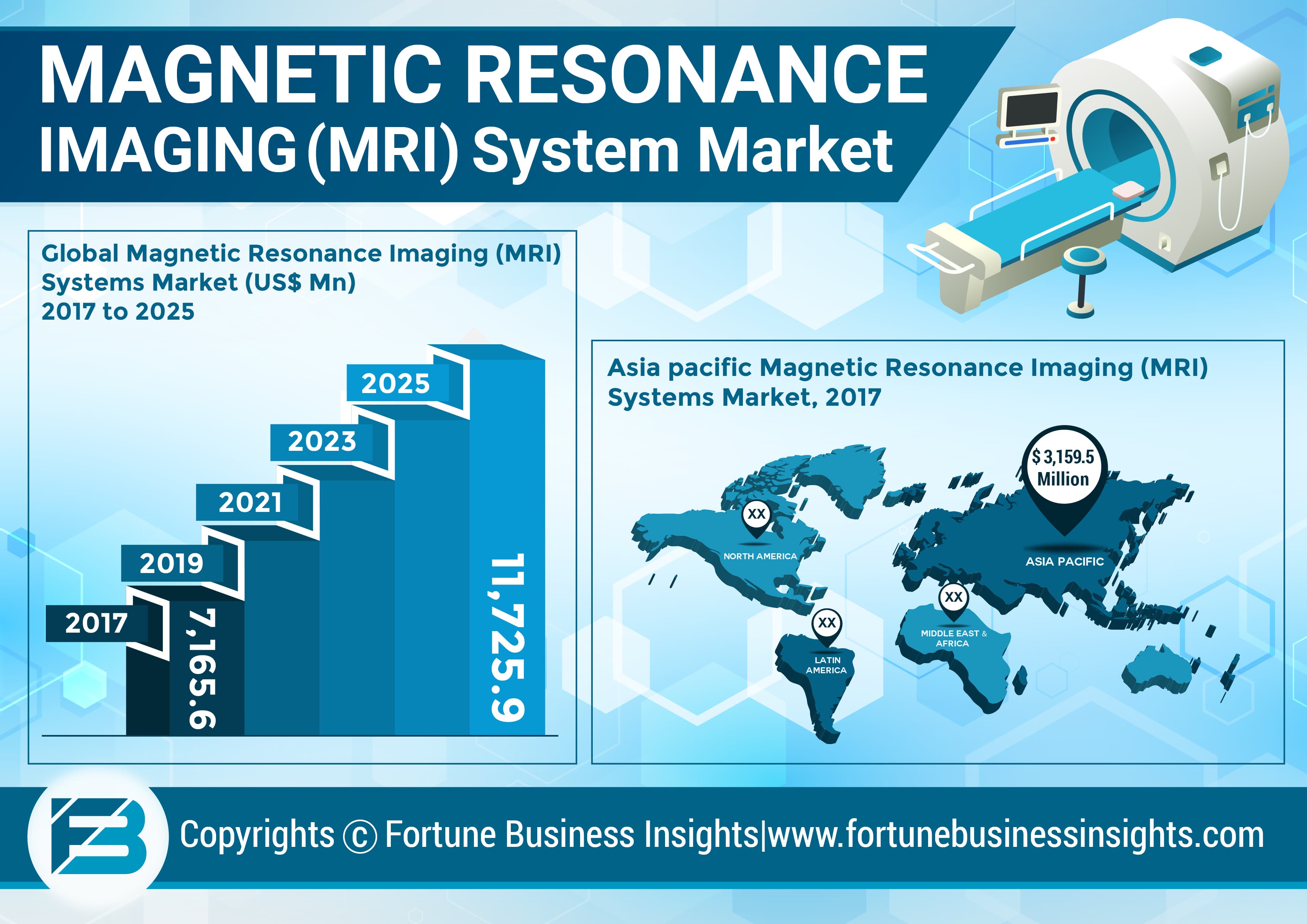 Magnetic Resonance Imaging Market by Size, Share, Report Overview, Industry Trend, Geography Forecast till 2025