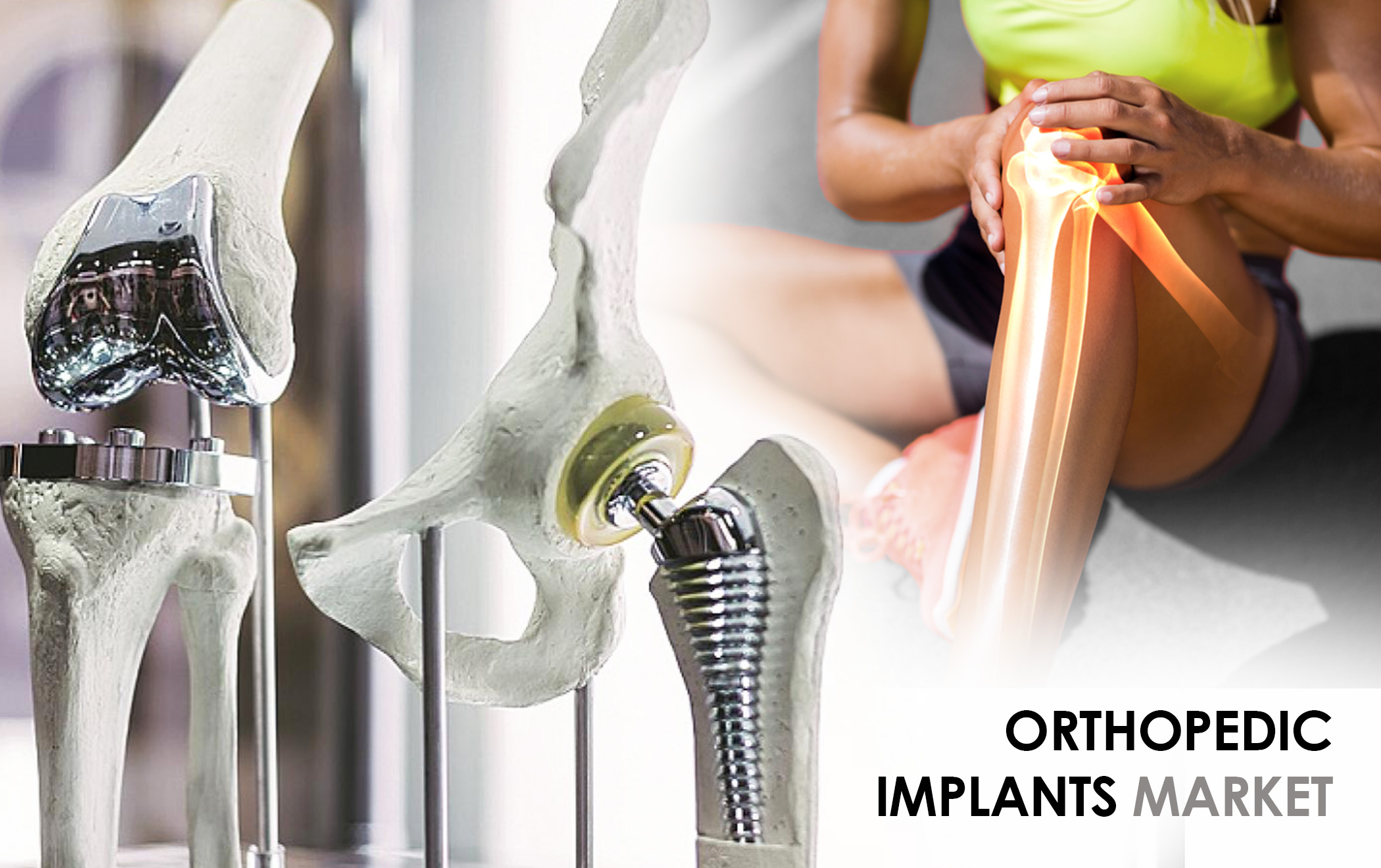 Global Orthopedic Implants Market is likely to witness CAGR of 4.7% from 2019 to 2030