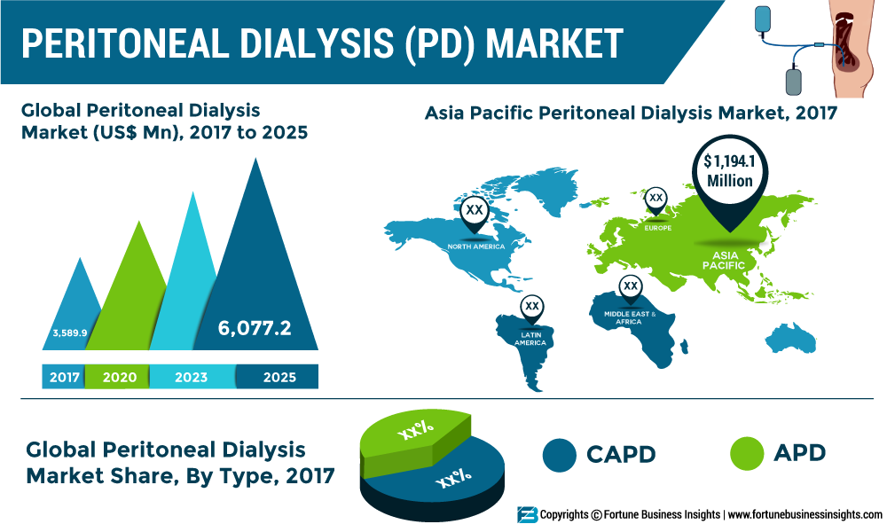 Peritoneal Dialysis Market Top Leading Players, Emerging Trends, Region by Forecast to 2025