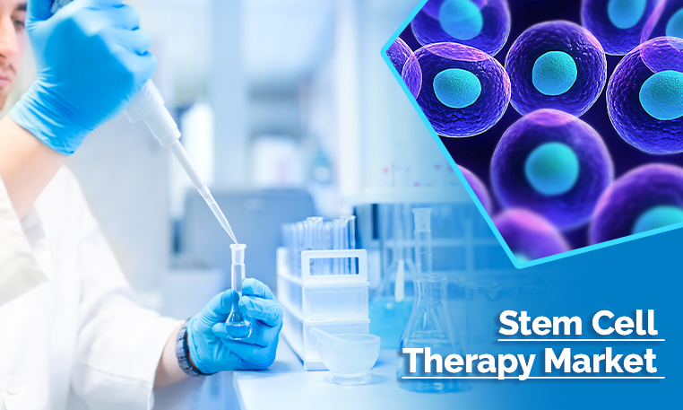 Stem Cell Therapy Market 2030 - Industry Demand, Emerging Trends and Growing Technology