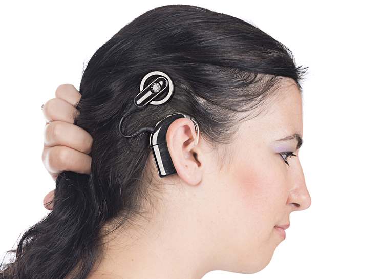 Cochlear Implants Market 2019: Latest Trends, Demand and Advancement by Cochlear Ltd., MED-EL, Sonova, Nurotron Biotechnology Co. Ltd., Medtronic, Demant A/S,Starkey And others-To 2027