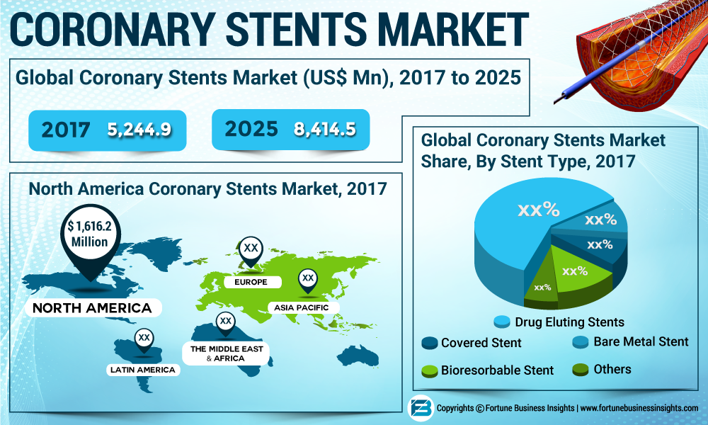 Coronary Stents Market Regional Trend & Growth Rate, Industry Analysis Projections By 2019-2025