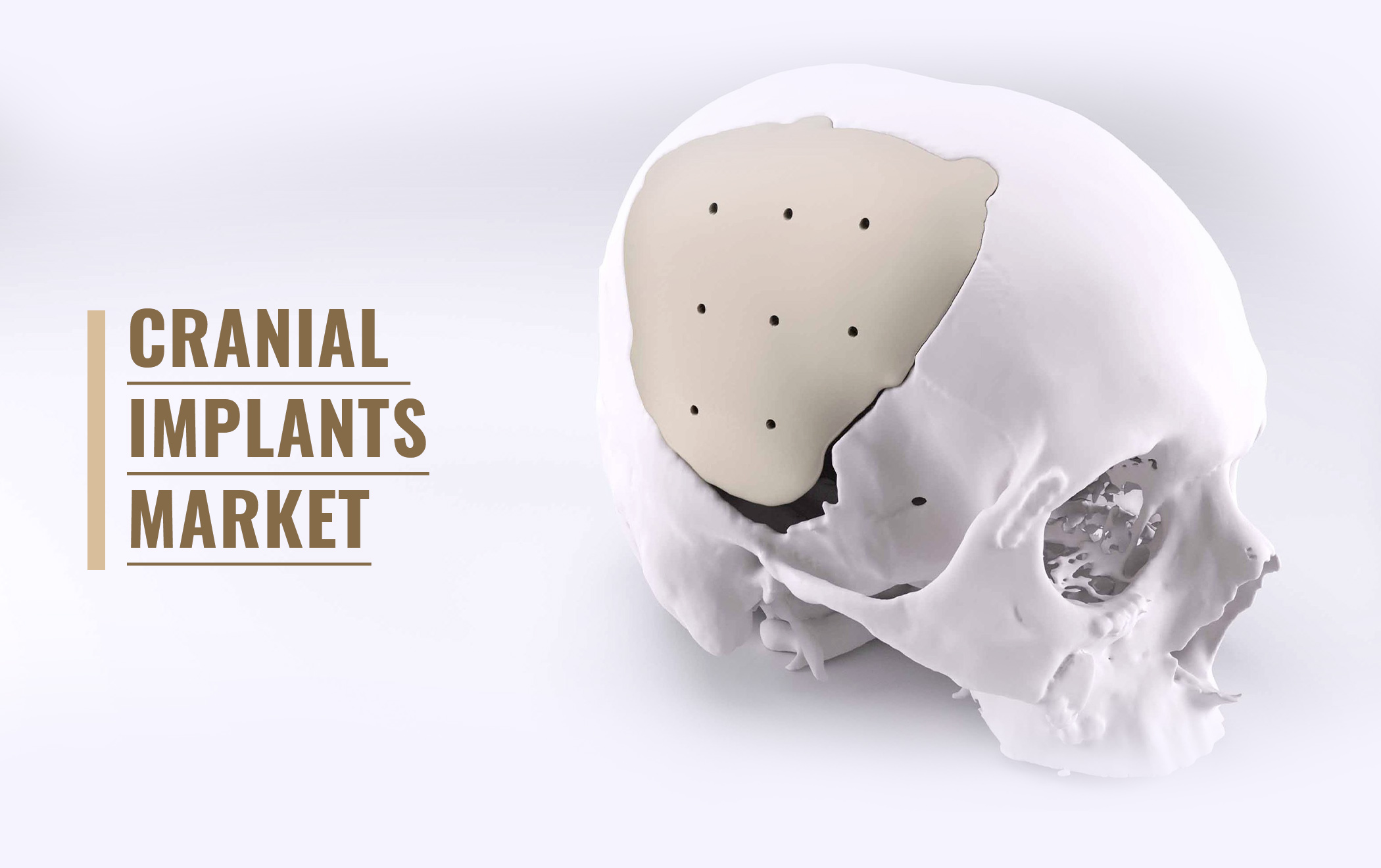 Global Cranial Implants Market is Likely to Register a CAGR of 6.2% Between 2019 to 2030