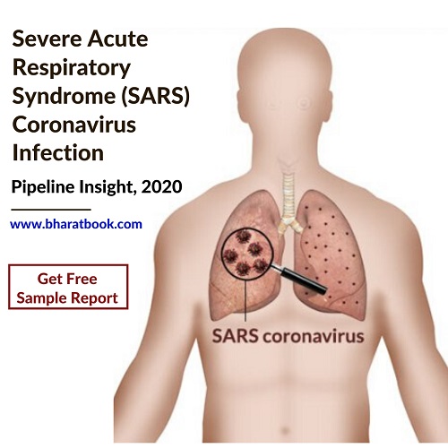 Severe Acute Respiratory Syndrome (SARS) Coronavirus Infection – Pipeline Insight, 2020
