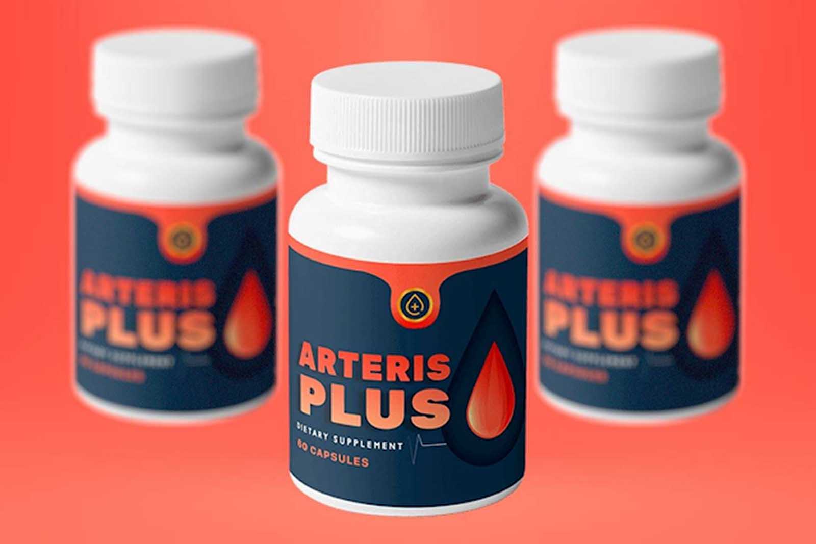 Arteris Plus