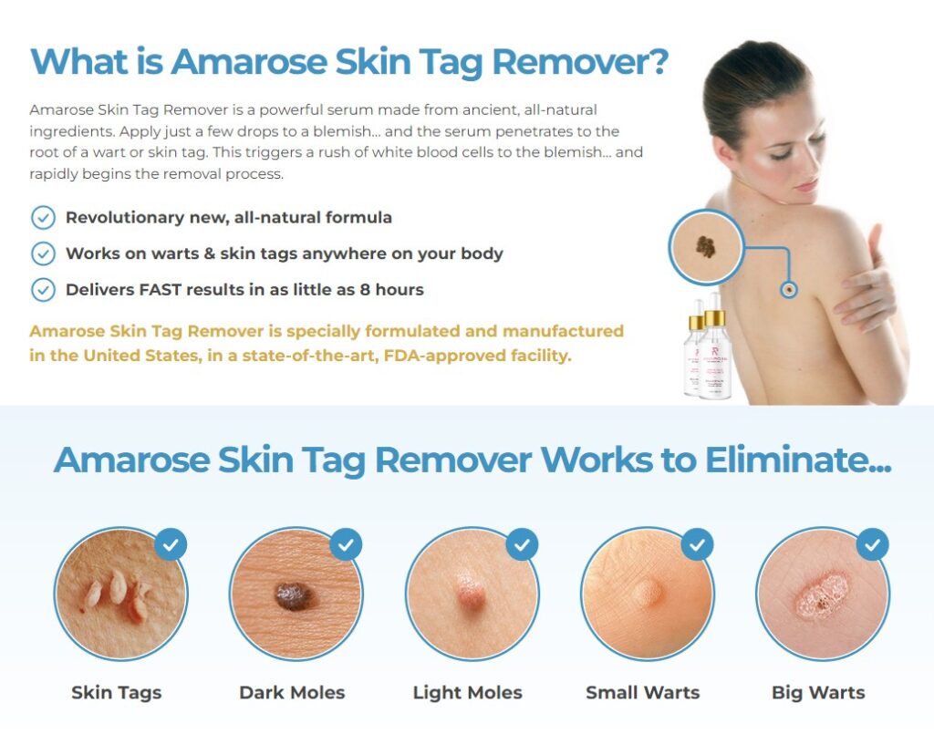 Amarose Skin Tag Remover Reviews: Results Before After, Uses ...