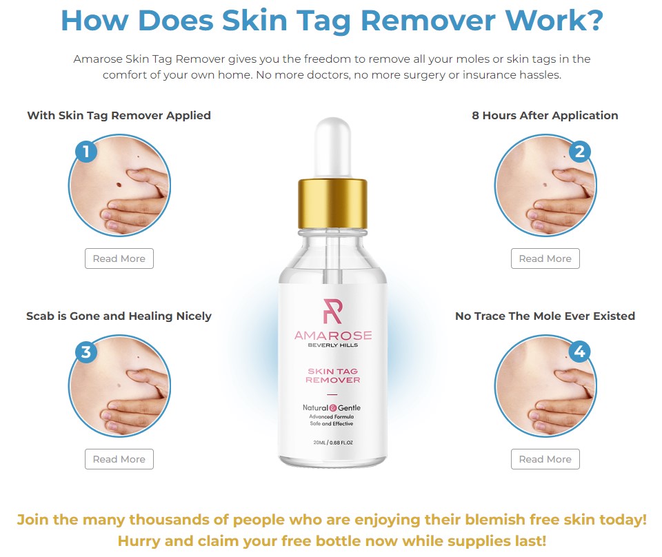 Amarose Skin Tag Remover2