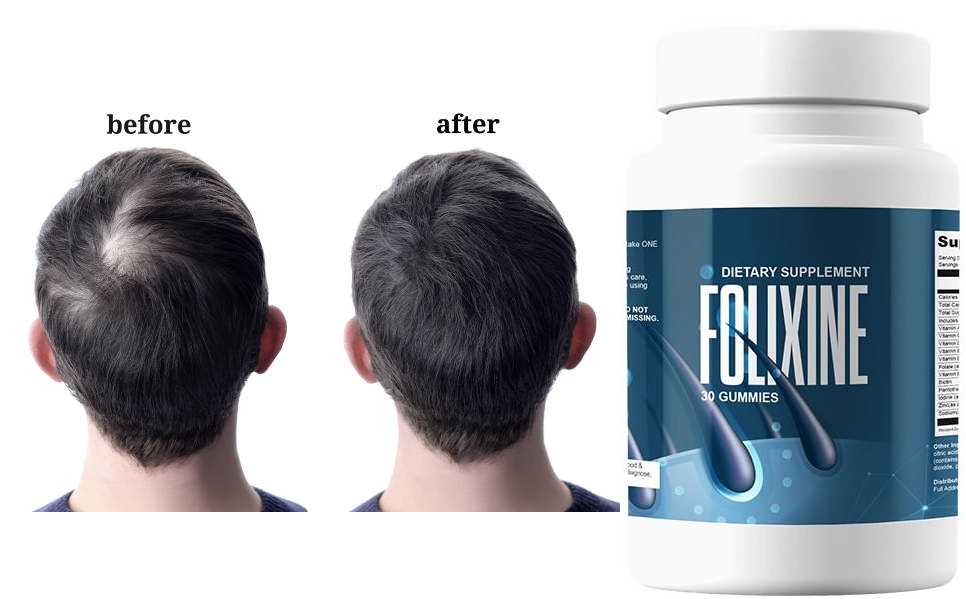 Folixine Reviews: Legit Hair Growth Formula, Uses, Precautions, Before ...