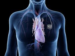3485 1690787350.cardiac pacemaker market overview
